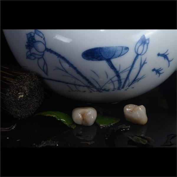 Personalized Strong Ceramic Zirconia Dental Crown Full Mouth Full Contour