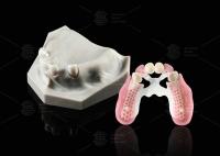 Biocompatibility Dental Telescope White Inner Zirconia Outer Peek Telescope Dental