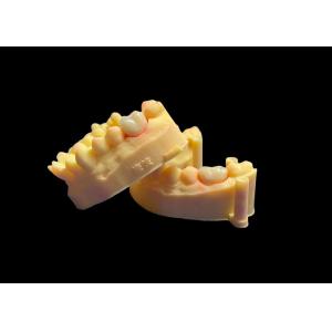 Премиальная цирконовая порцелановая зубная корона непревзойденная прочность точность приспособления и исключительная эстетика и долговечность