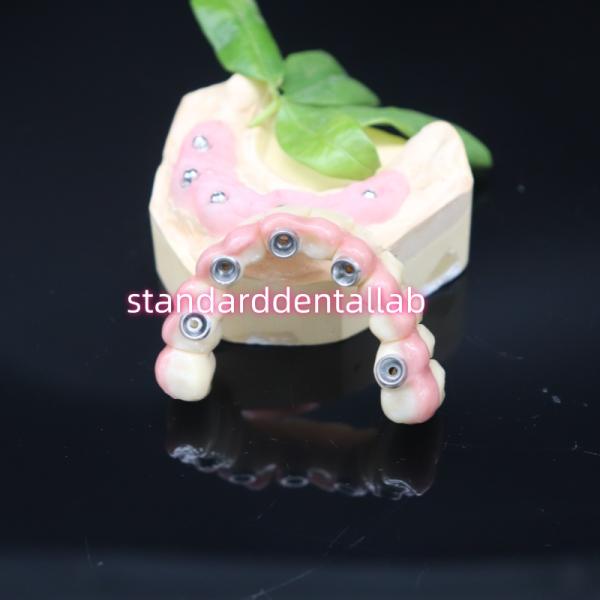 Todo atornillado en 6 Puente de zirconio completo Dental de alta precisión sobre la base de Ti