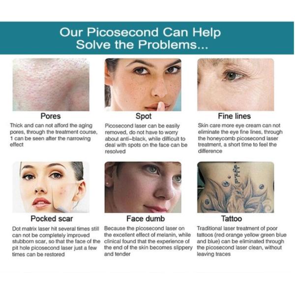 Q Switched Nd Yag Tattoo Removal Machines , High Power Pico Laser Machine