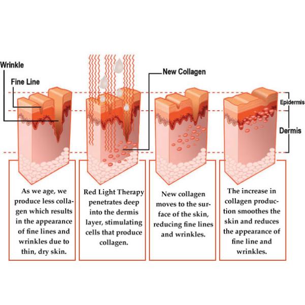 Кровати терапией красного света фитнеса планеты для вызревания продукции коллагена анти-