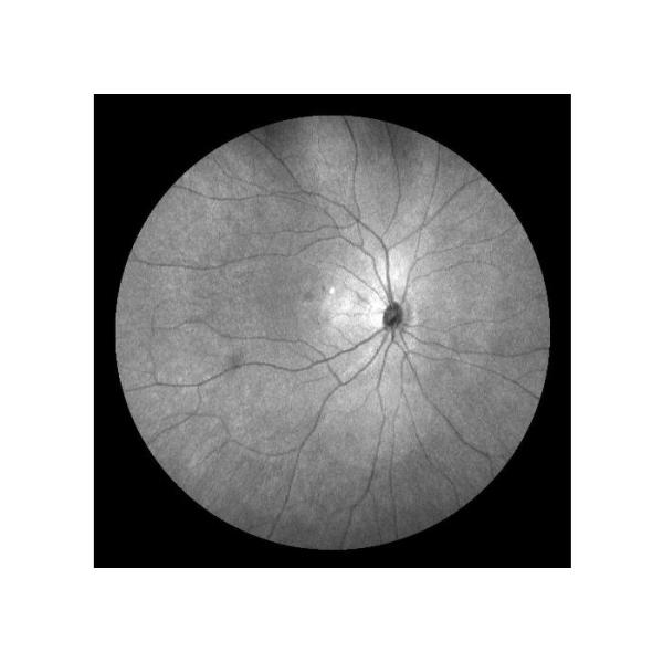 Equipo oftálmico de Angiograph Digital 160° de la retina