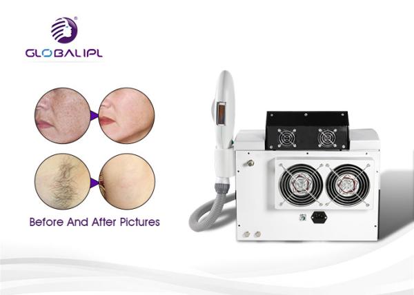 E Light 6MHZ 15*50mm² 640nm IPL RF Beauty Equipment