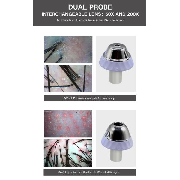 ABS PC 15 Inch HD Screen 200X Camera USB Digital Hair And Skin Analyzer