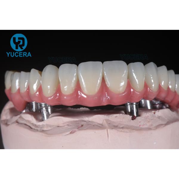 1200HV Yucera Dental Implant Zirconia Abutment For Lab 3D Pro