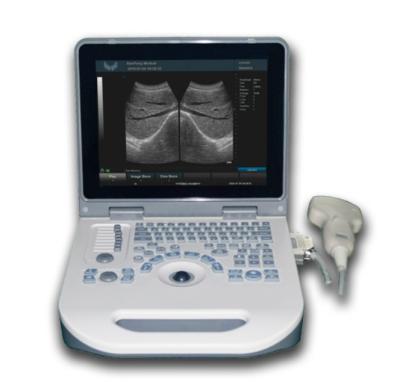 TGC Control Notebook Scanner Laptop Ultrasound Machine For Pregnancy Home