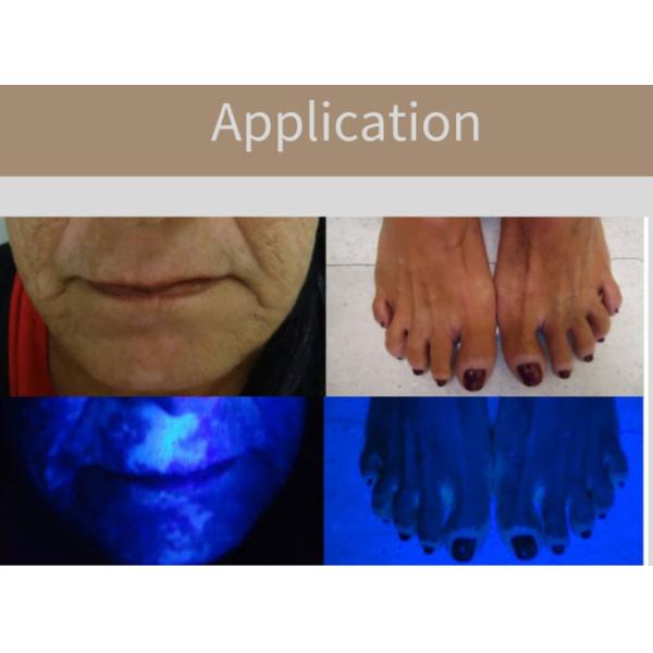 Woods Lamp Skin Examination Veterinary 9000C Kernel Medical Equipment