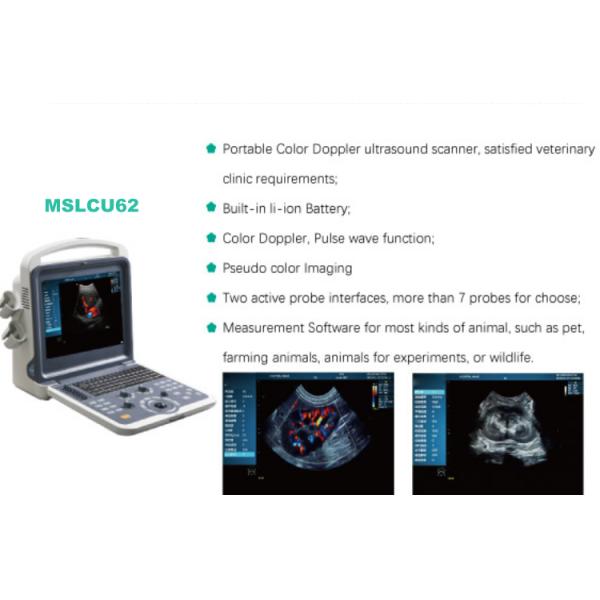 2d /3d/4d Medical Ultrasound Machine