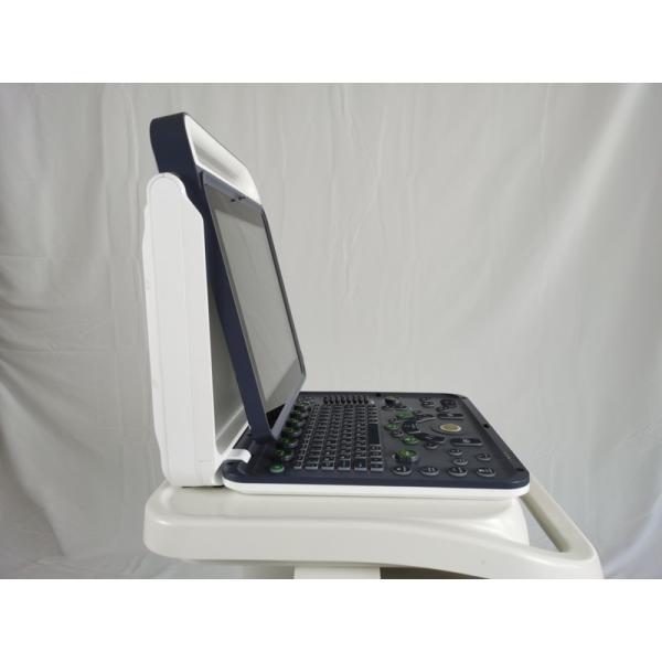 Hospital Outside 2020 New Portable Digital 15 Inch Color Doppler Ultrasound Machine