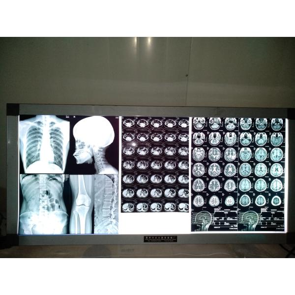 210mmx279mm Blue X Ray Film Inkjet Medical Film For Digital Imaging Output