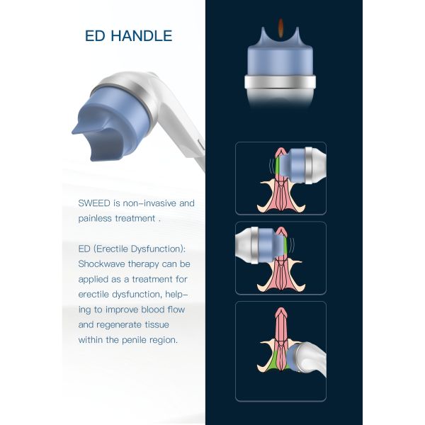 Équipement de thérapie par ondes de choc à focalisation professionnelle 2025 pour le soulagement de la douleur, la relaxation musculaire et la récupération en physiothérapie des blessures sportives