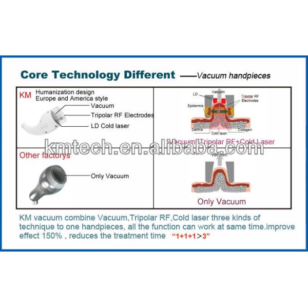 Система вакуумной кавитации 25 кГц 40 кГц Настольная машина для похудения