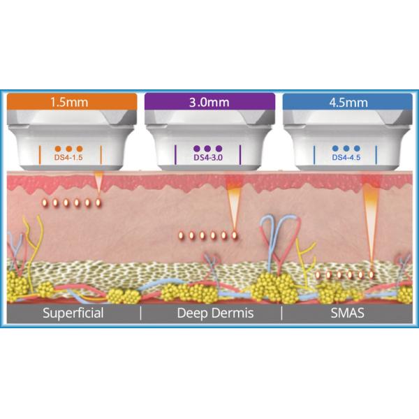 Women Vertical HIFU Equipment 4.0Mhz Effective With 10000 Shots