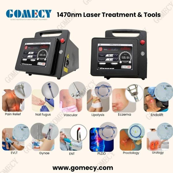 15W/20W 1470nm Endolaser for Liftinging Facial Lipolysis and Endovenous Laser Spider Vein Removal 3 Meters Fiber