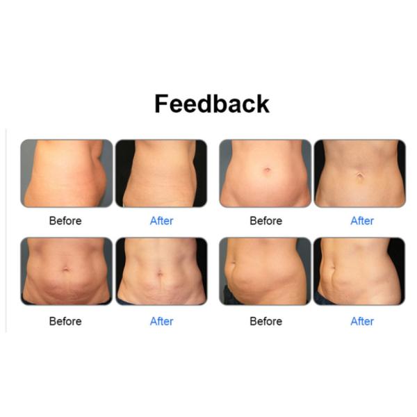 5D Липо лазерная машина для похудения 650nm 780nm 808nm 940nm 980nm