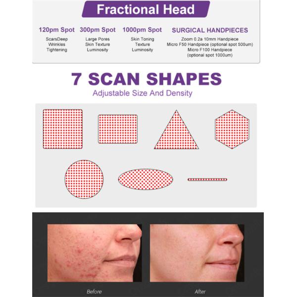 Effective Fractional Laser Co2 Machine For Vaginal Treatment