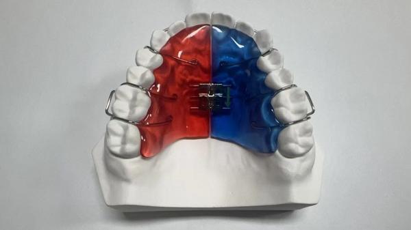 2.4 Ounces Implant Cases for Dental Sterilization Steam Sterilization