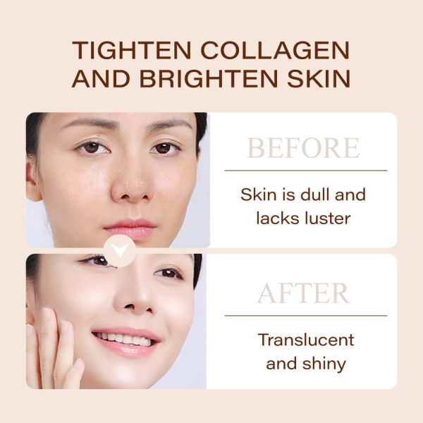 Bifid Yeast Firming Facial Anti Ageing Ordinary Face Vitamin C Skin Care Moisturizing Skin Whitening Anti-aging Serum for Face
