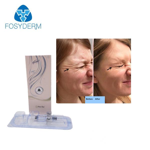 2ml Injectable BDDE Cross Linking Hyaluronic Acid Filler Injection For Lip Volume