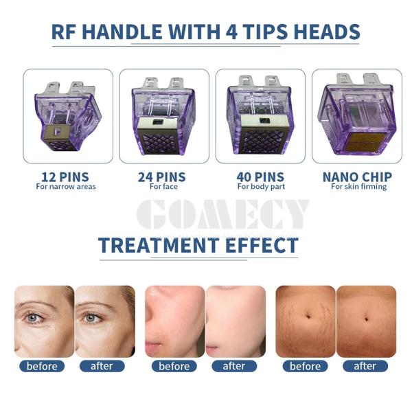 2024 3 в 1 Inmode Morpheus 8 Body Slimming Beauty Machine Радиочастотное оборудование RF Утяжелительное устройство для кожи