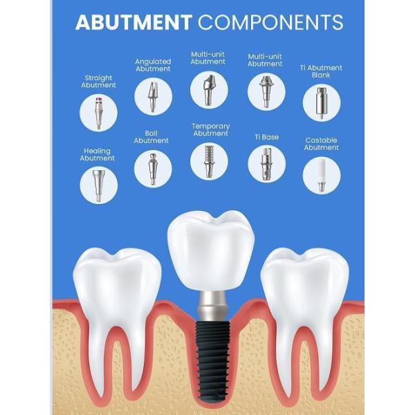 Pure Titanium Dental Implant Bone Level Fixture CE/ISO13485 S.L.a Surface Customized