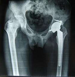 Filme seco médico 28cm * 35cm da imagem latente de Konida da baixa base azulada do poliéster da névoa para a impressora térmica
