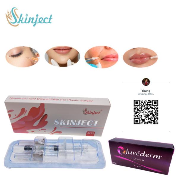 заполнитель 1ml Juvederm дермальный для стороны губы извлекая морщинки Skinject Allergan
