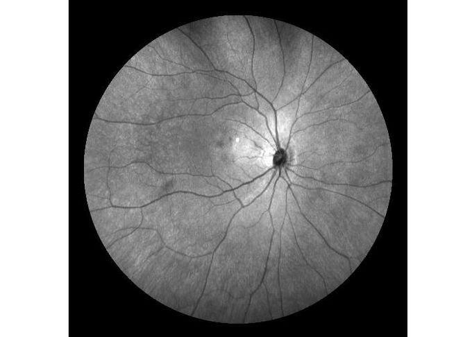 Оборудование камеры Fundus сканирования лазера профессиональное офтальмическое с Fundus отображая размер зрачка FOV 160° минимальный 2 mm