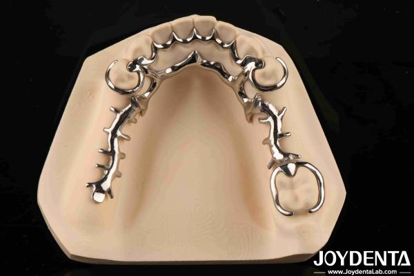 Alloying Metal Materials Dental Framework Suppleness for Oral Health Practitioners