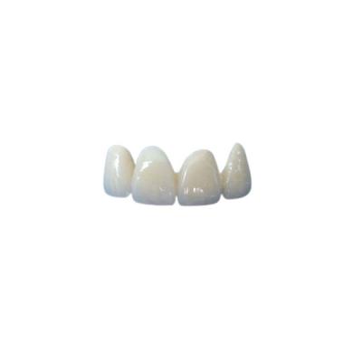 Good Stability Ceramic Dental Crown Fit Properly Oral Hygiene High Quality