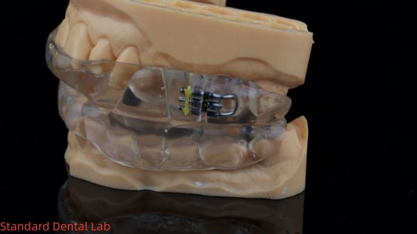 Appareils dentaires fonctionnels d' automne d' orthodontie du laboratoire dentaire chinois