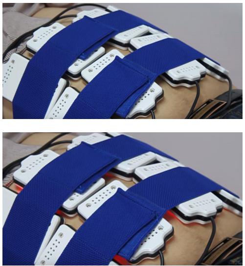 Fat Freezing Medical Cryolipolysis Machine For Face / Body Shaping And Lifting