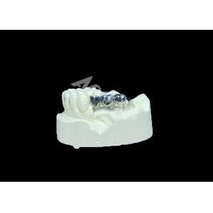 Долговечный титановый зубной имплантат для замены недостающих зубов