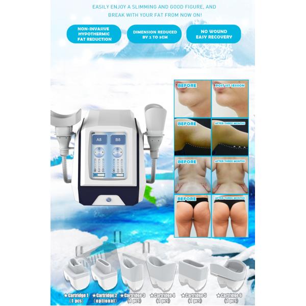 CE FDA Portable Cryolipolysis 110V/220V Body Slimming Fat Freezing Machine