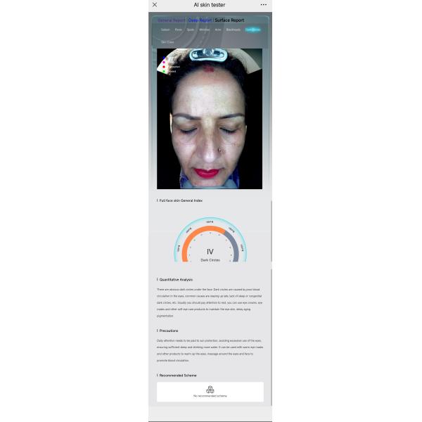 Skin Analyzer Reports Bitmoji Max Plus Facial Scanner Skin Scope Analysis Device