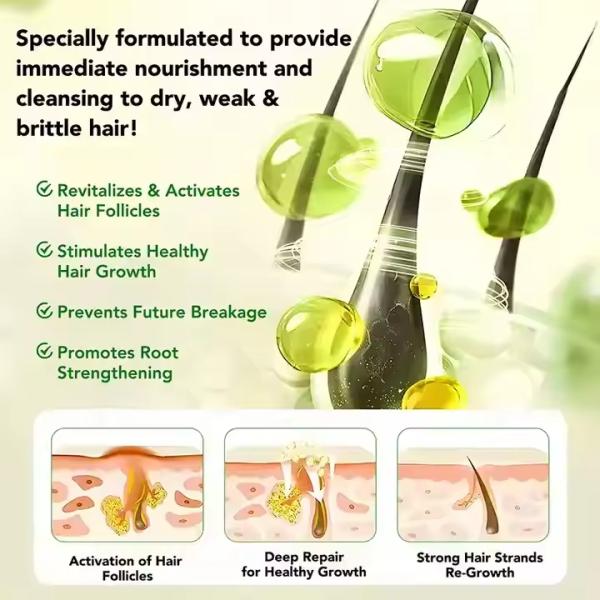 Suero para el cuidado del cuero cabelludo con romero infundido OEM Productos para el cuidado del cabello personalizados