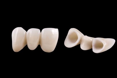 CAD CAM Design Dental 3D Print