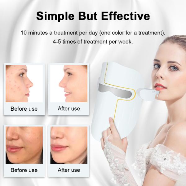 Перезаряжаемые красная голубая светлая терапия СИД лицевого щитка гермошлема для Ance/анти- вызревания