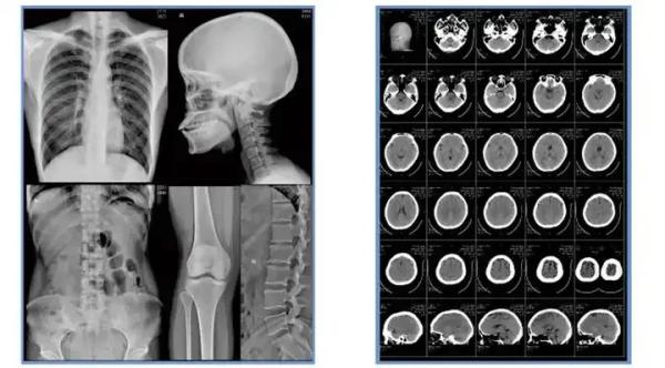 A4 Size Sheets Blue Inkjet Medical Film For Medical Image