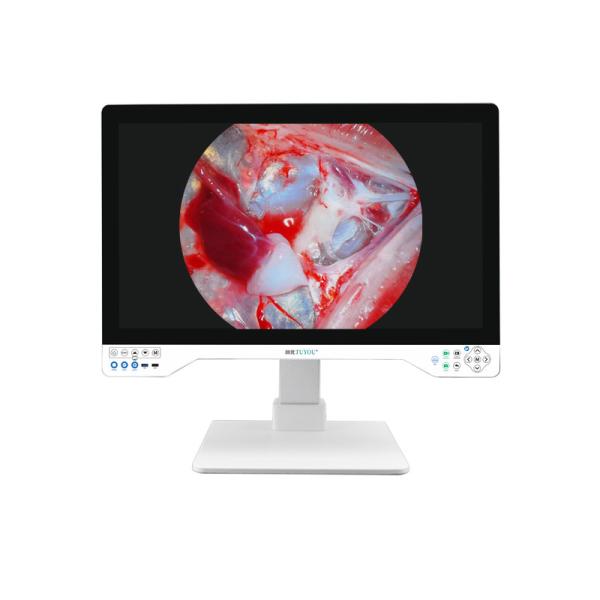 Advanced 32 4K Endoscopy Camera With Integrated Light Source And Display For Laparoscopic System