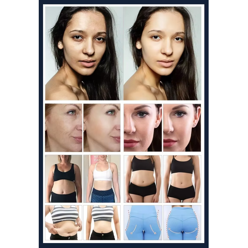 2Handles Body Slimming Face Lifting Diathermy Deep Care 448KHz Rf Tecartherapy Machine