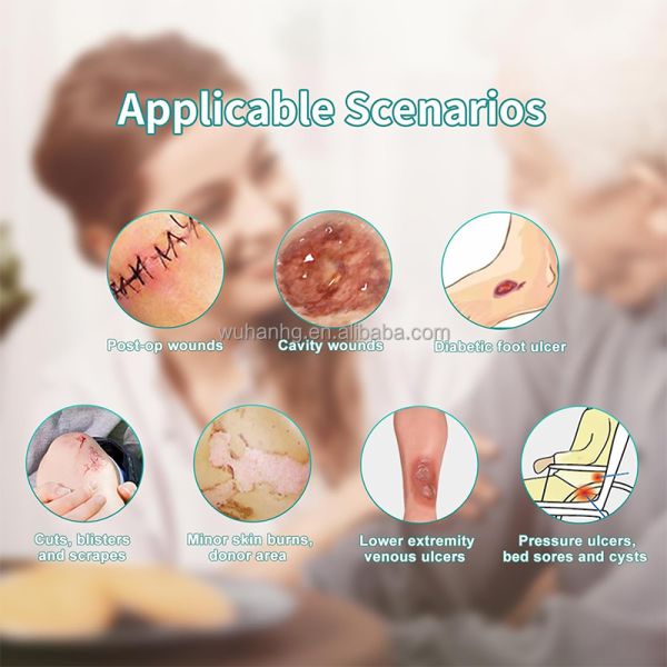 High Absorbency Calcium Alginate Dressing 10x10 For Hospital Wound Care