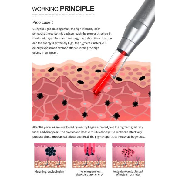 Vertical Q Switched Tattoo Removal Picosure Picosecond Nd Yag Laser Machine