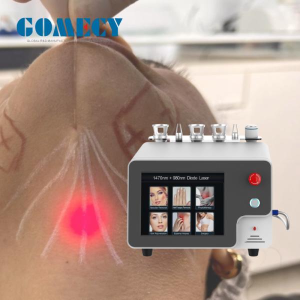 Professional 1470Nm 980Nm Laser Endolifting Machine Smart Light Anti-Aging Facial Slimming