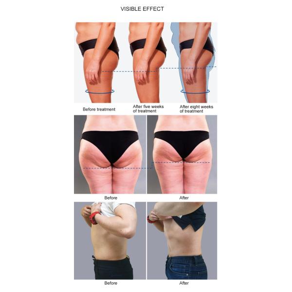 2 в 1 ролике кавитации вакуума целлюлита машины терапией  уменьшая глубокий контурить тела массажа