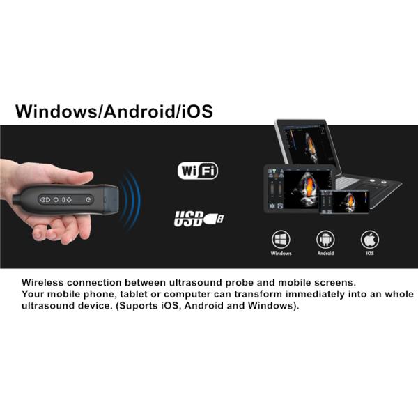 Mobile Hand Ultrasound Machine Ultrasonication Probe Supported Windows / Android / IOS
