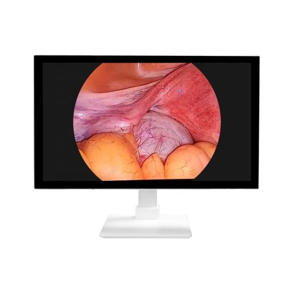 TUYOU 4K 32'' Medical All In One Rigid  Endoscopy Camera System with LED Light Source For ENT Laparoscopy