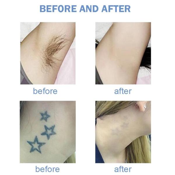 IPL OPT SHR Laser Hair Removal Equipment / Multifunction Beauty Machine