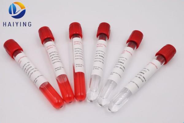 Medium Nasopharyngeal Blood Specimen Tubes UTM